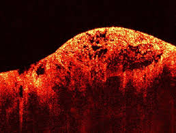 simple eye scan of retina