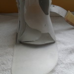 My orthosis, 10 weeks later